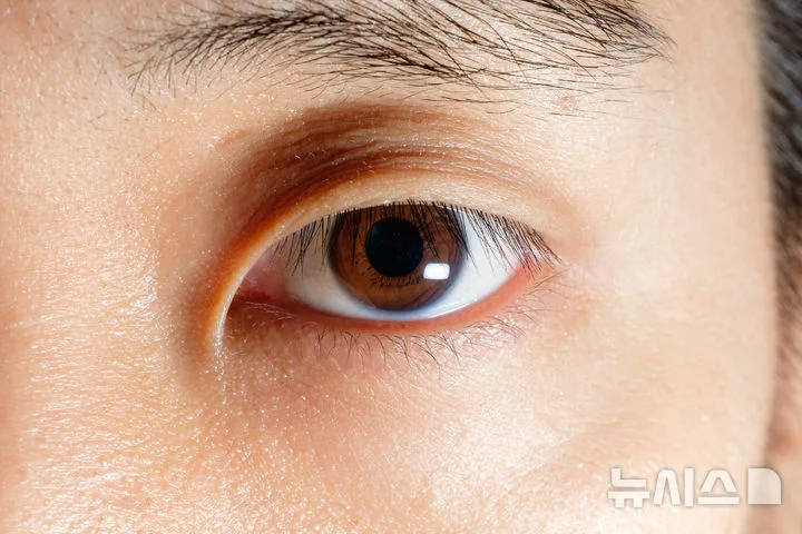비문증, 갑자기 늘거나 번쩍이면 망막 검사 받아야 합니다